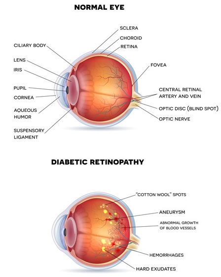 Eye Checkup