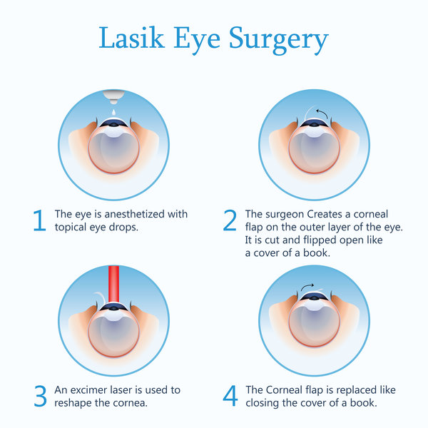 Eye Checkup